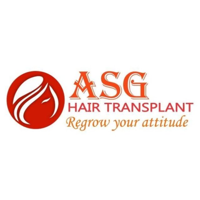 ASG Hair Transplant Centre - Hair Transplant Cost in Punjab